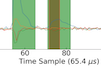 Burst analysis